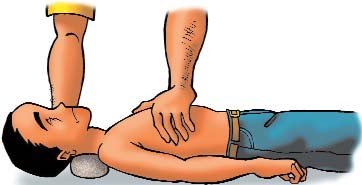  PRIMEROS AUXILIOS (35)  IMAGENES DIBUJOS JPG GALICIA